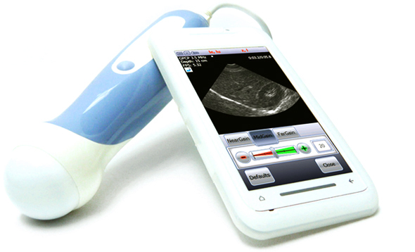 mobile_apps_internet_of_things_ultrasound_device